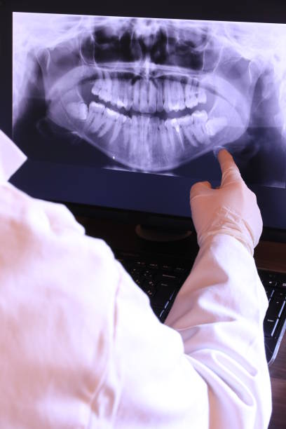 Best Emergency Dental Surgery in Atkinson, NE