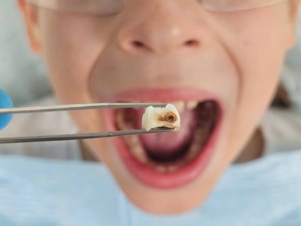 Best Emergency Dental Care for Trauma or Injury in Atkinson, NE